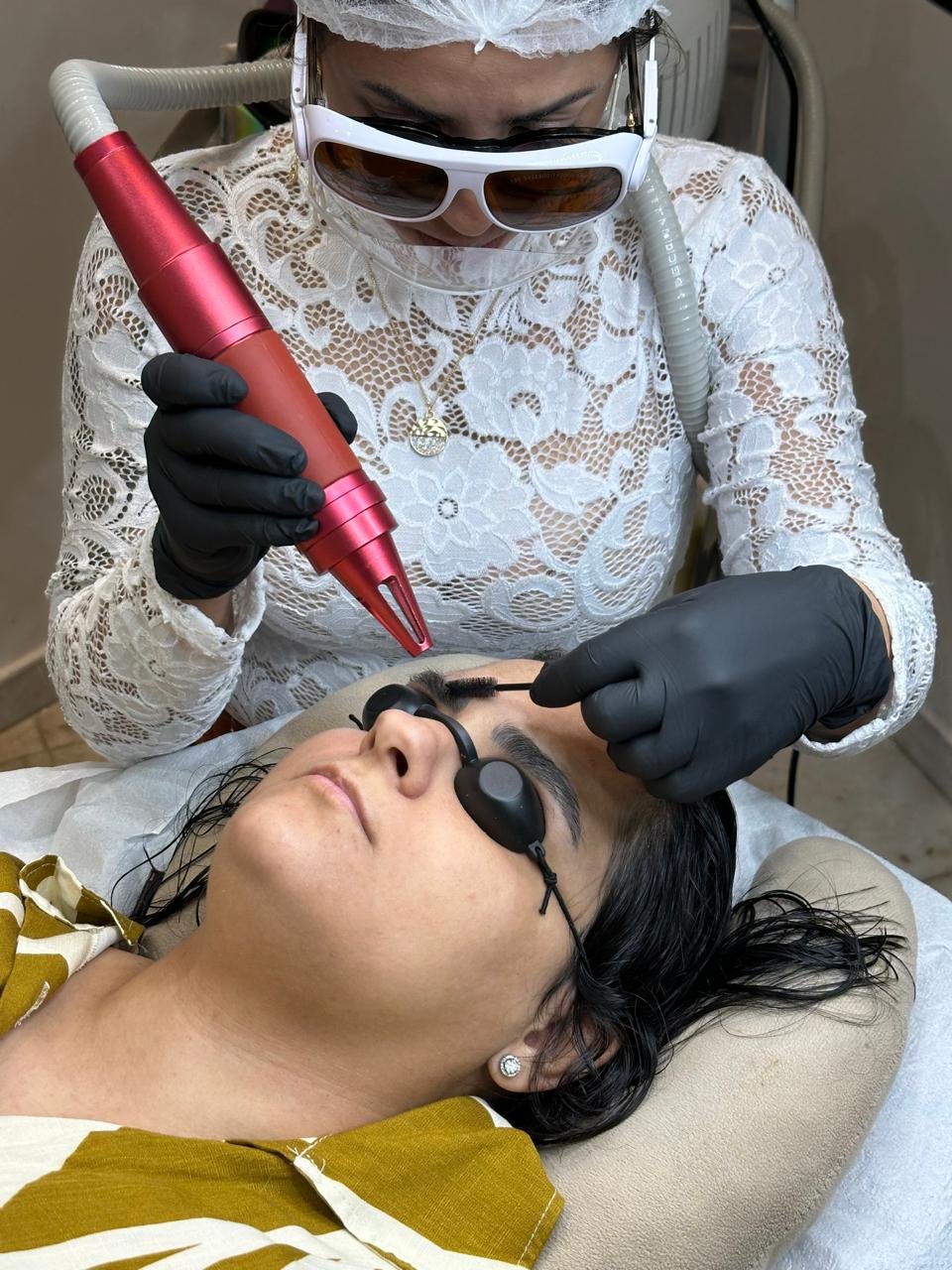 Atendimento de remoção a laser